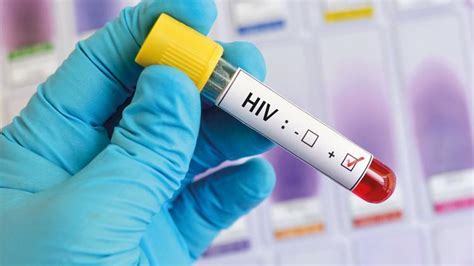 İ­n­g­i­l­t­e­r­e­’­d­e­ ­H­I­V­ ­s­k­a­n­d­a­l­ı­